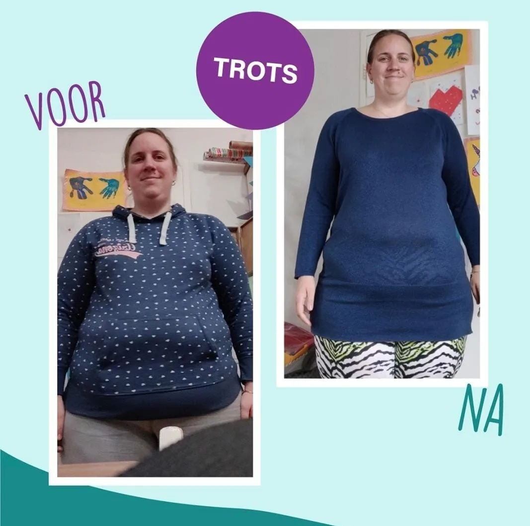 Voor-en-nafoto van Vera na haar traject met de VacuBike en voedingsbegeleiding