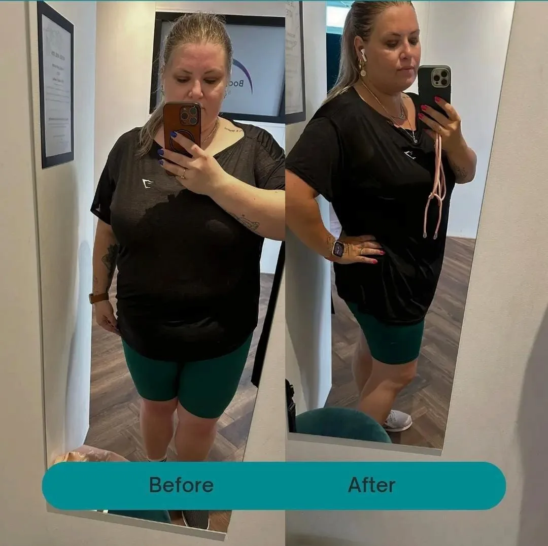 Voor-en-nafoto van Vienna na haar traject bij Body Shape & Beauty